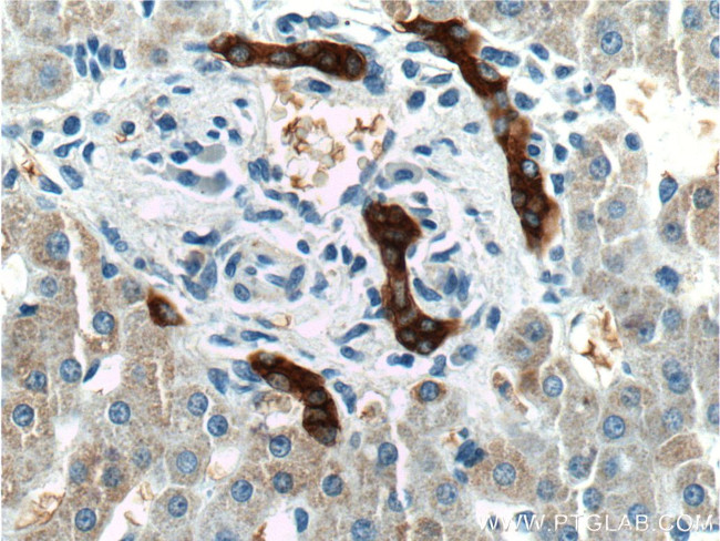 GCK Antibody in Immunohistochemistry (Paraffin) (IHC (P))