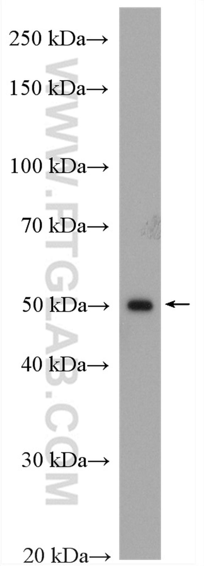 GCK Antibody in Western Blot (WB)