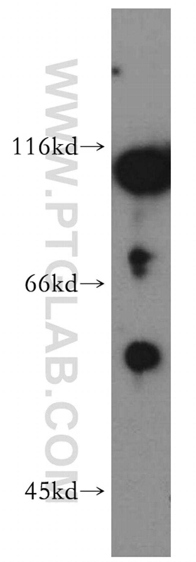 GCK Antibody in Western Blot (WB)