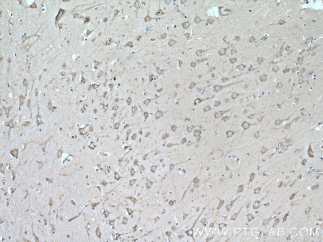 MYH10 Antibody in Immunohistochemistry (Paraffin) (IHC (P))