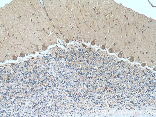 MYH10 Antibody in Immunohistochemistry (Paraffin) (IHC (P))