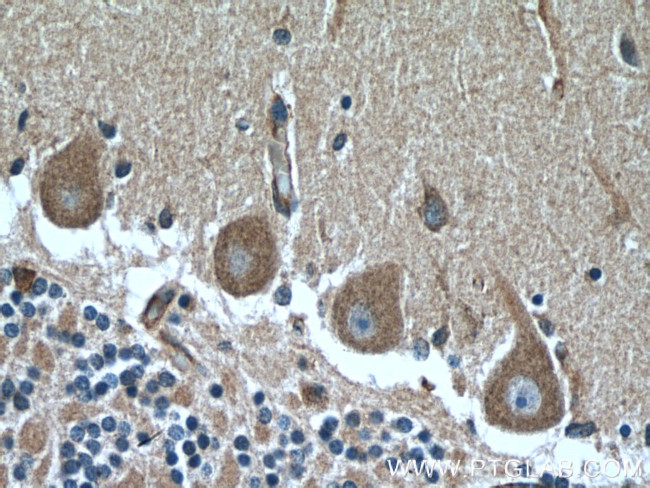 MYH10 Antibody in Immunohistochemistry (Paraffin) (IHC (P))