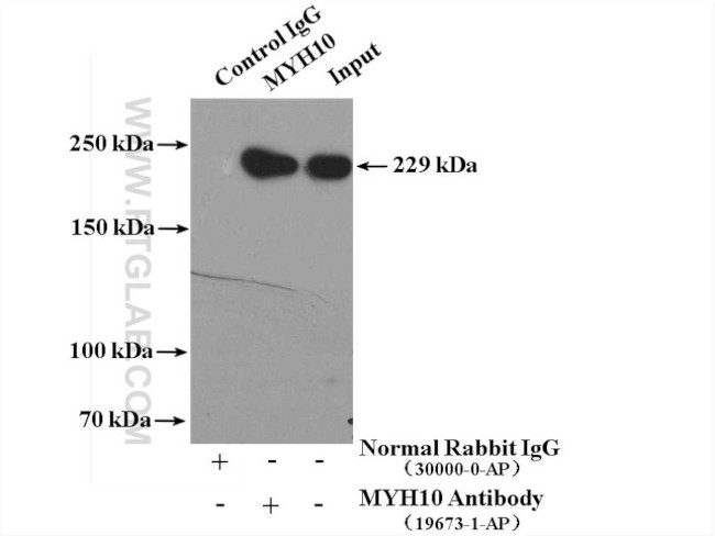 MYH10 Antibody in Immunoprecipitation (IP)