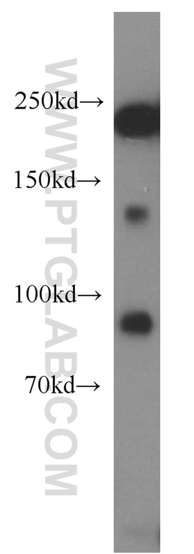 MYH10 Antibody in Western Blot (WB)