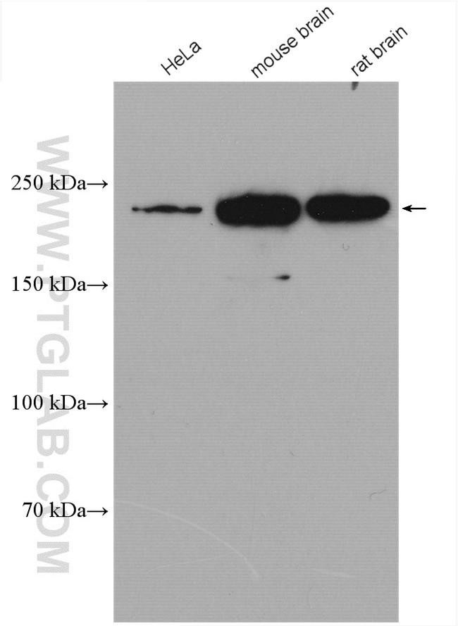 MYH10 Antibody in Western Blot (WB)