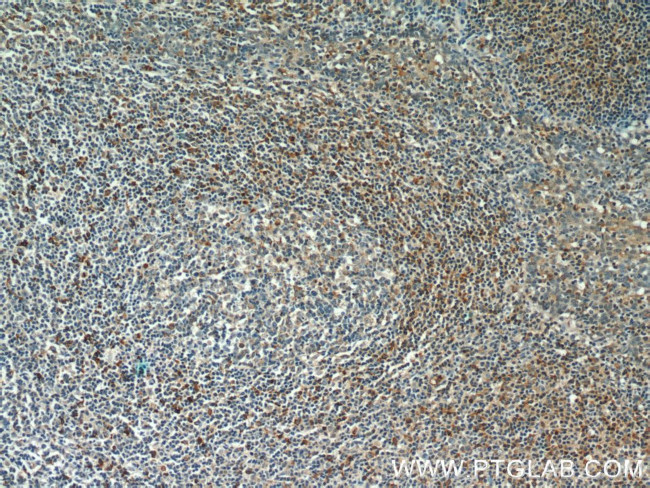 Integrin alpha-4 Antibody in Immunohistochemistry (Paraffin) (IHC (P))