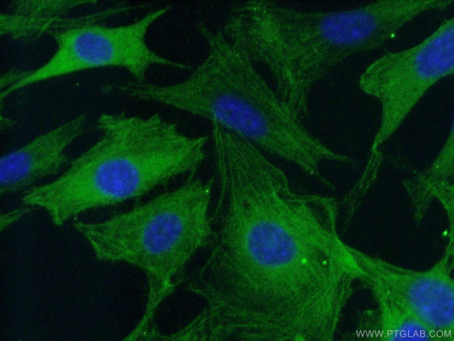 Caspase 3 Antibody in Immunocytochemistry (ICC/IF)