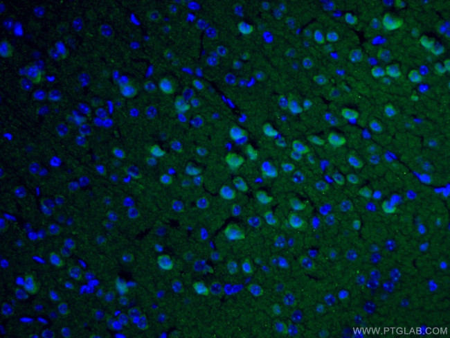 Caspase 3 Antibody in Immunohistochemistry (PFA fixed) (IHC (PFA))