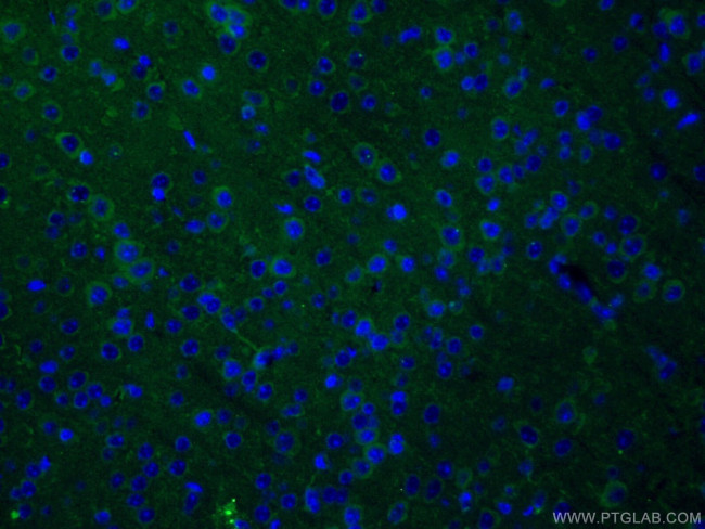 Caspase 3 Antibody in Immunohistochemistry (PFA fixed) (IHC (PFA))