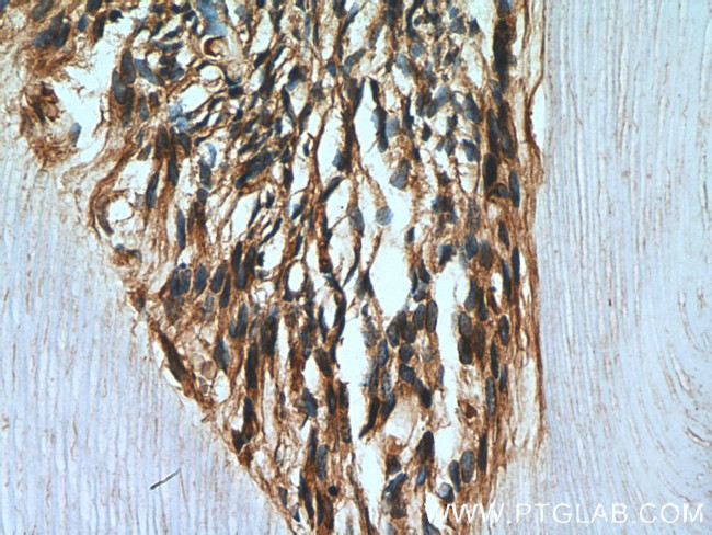 Caspase 3 Antibody in Immunohistochemistry (Paraffin) (IHC (P))