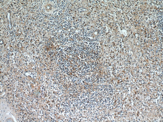 Caspase 3 Antibody in Immunohistochemistry (Paraffin) (IHC (P))