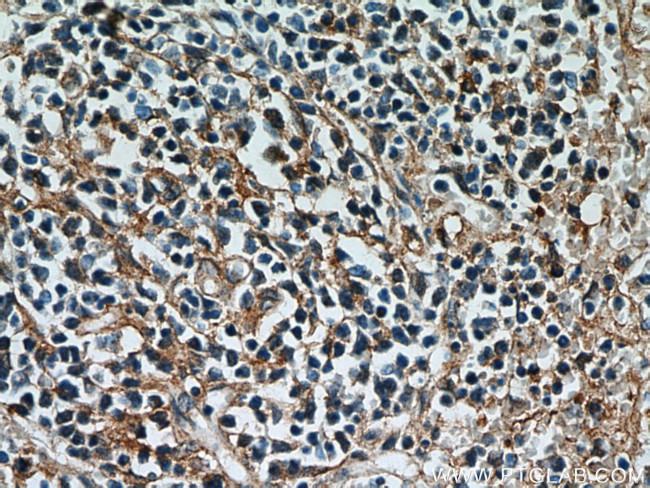 Caspase 3 Antibody in Immunohistochemistry (Paraffin) (IHC (P))