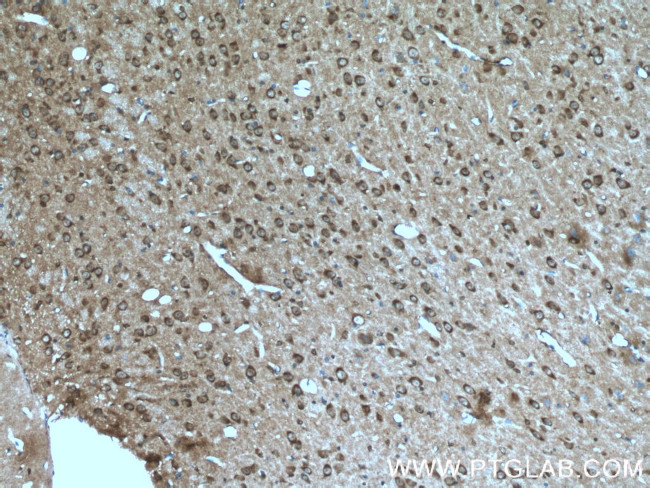 Caspase 3 Antibody in Immunohistochemistry (Paraffin) (IHC (P))