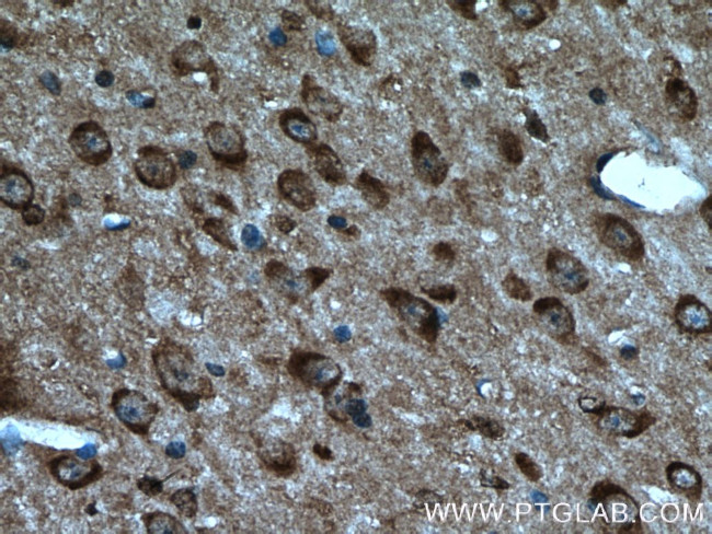 Caspase 3 Antibody in Immunohistochemistry (Paraffin) (IHC (P))