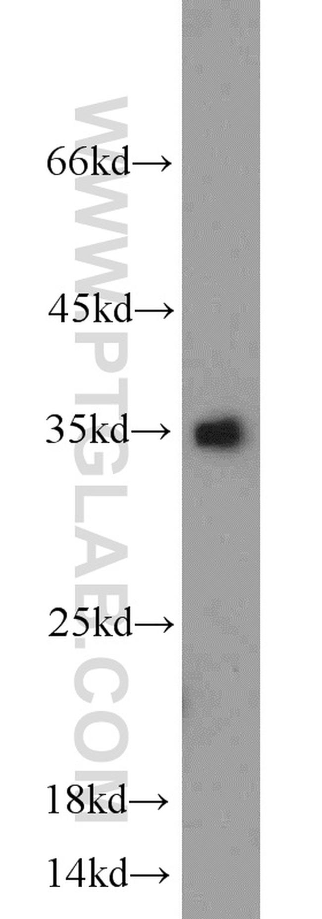 Caspase 3 Antibody in Western Blot (WB)