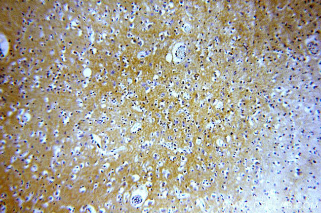 PMCA2 Antibody in Immunohistochemistry (Paraffin) (IHC (P))