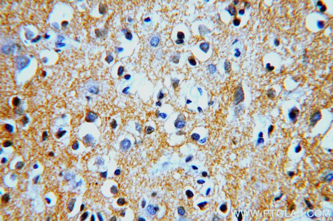 PMCA2 Antibody in Immunohistochemistry (Paraffin) (IHC (P))