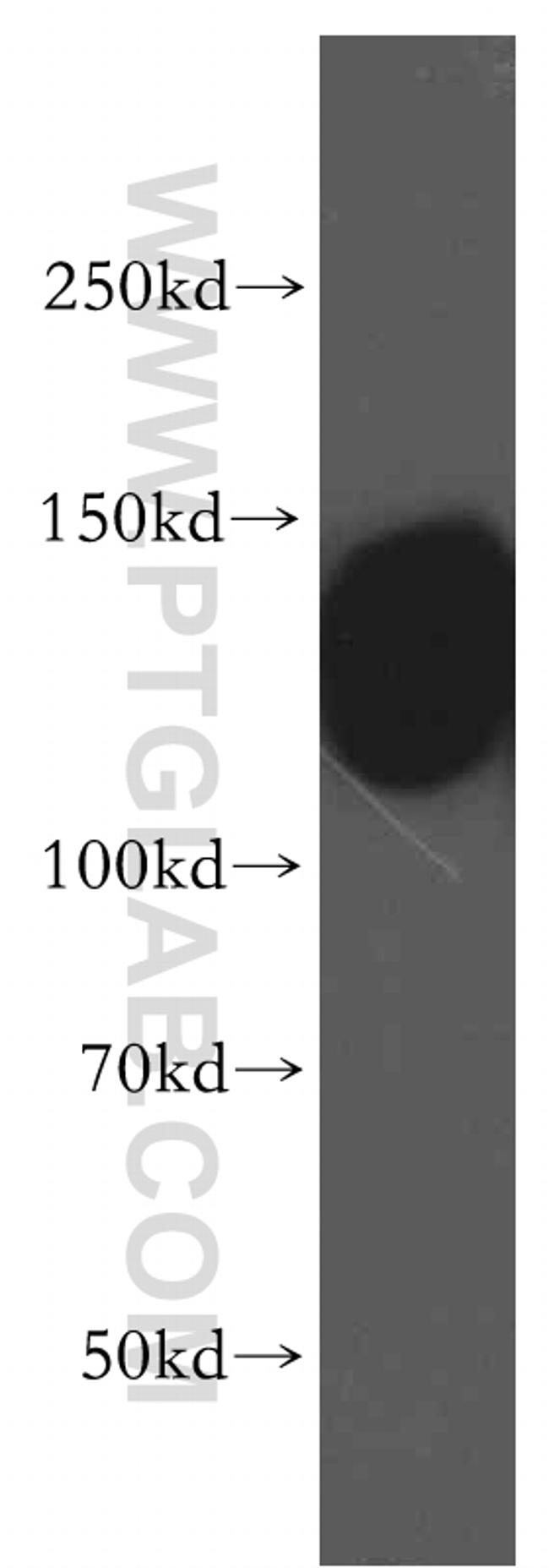 PMCA2 Antibody in Western Blot (WB)