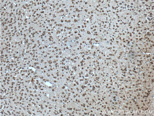 CACNA1B Antibody in Immunohistochemistry (Paraffin) (IHC (P))