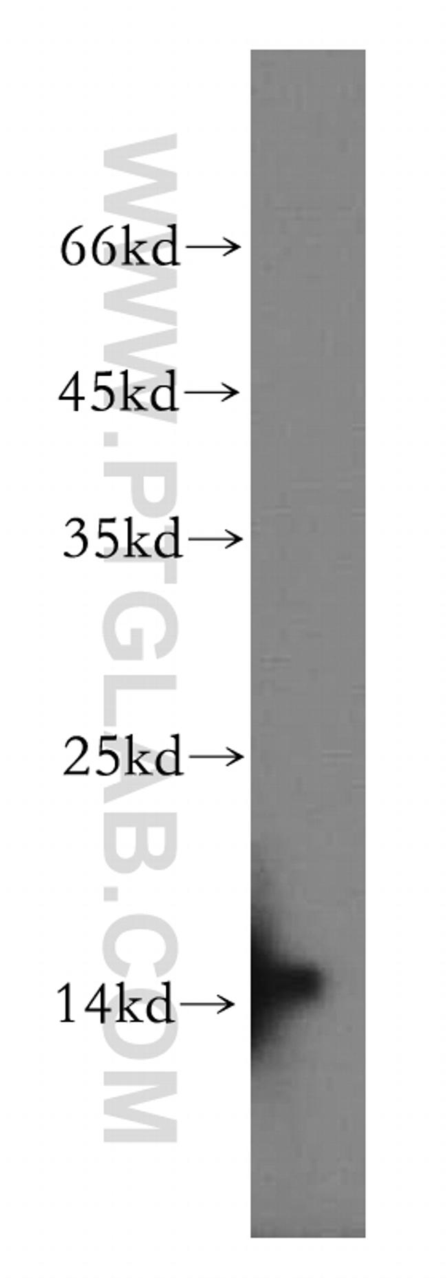 BLOC1S1 Antibody in Western Blot (WB)