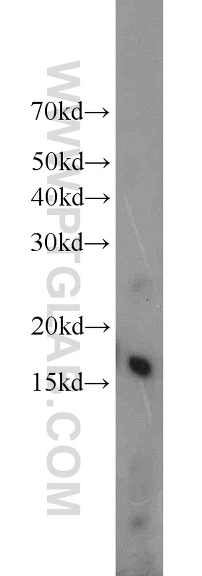 BLOC1S1 Antibody in Western Blot (WB)