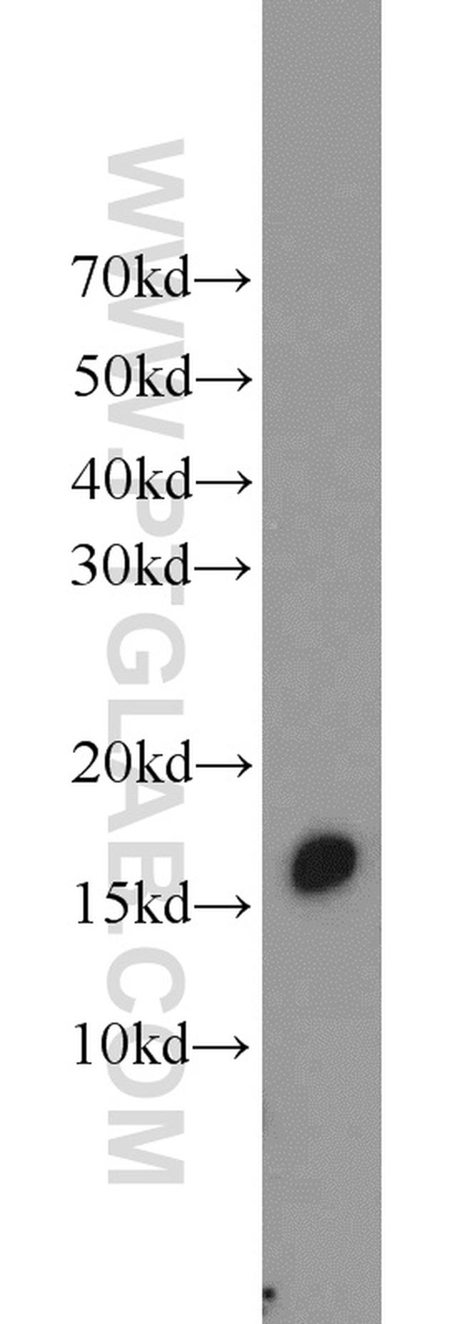 BLOC1S1 Antibody in Western Blot (WB)