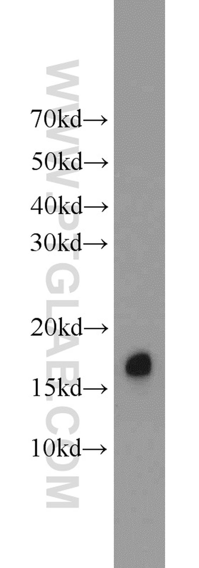 BLOC1S1 Antibody in Western Blot (WB)