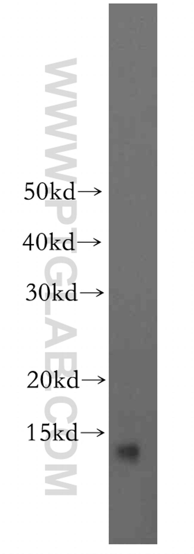 BLOC1S1 Antibody in Western Blot (WB)