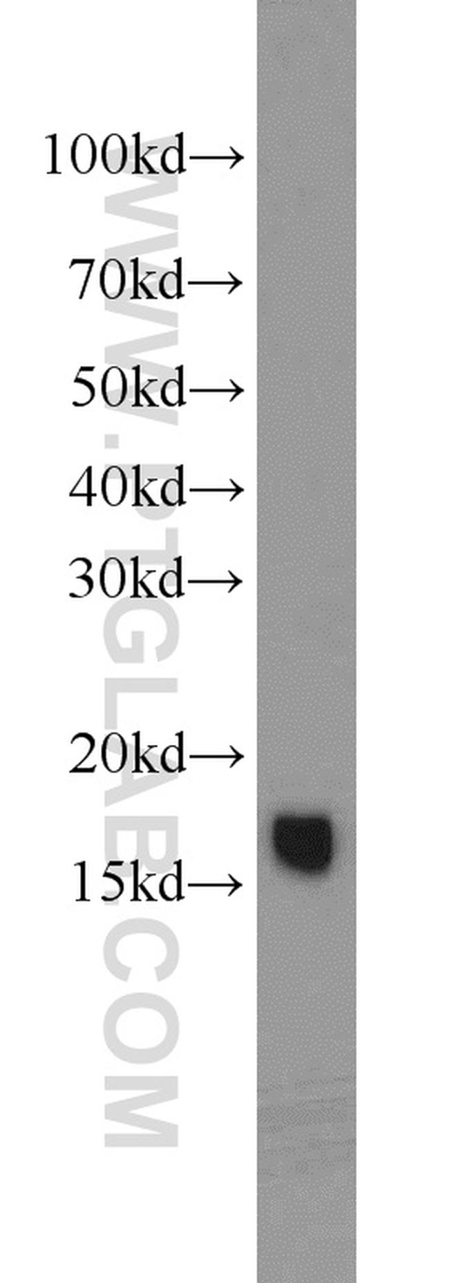 BLOC1S1 Antibody in Western Blot (WB)