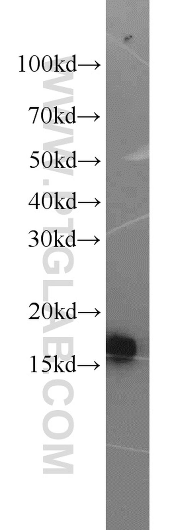 BLOC1S1 Antibody in Western Blot (WB)