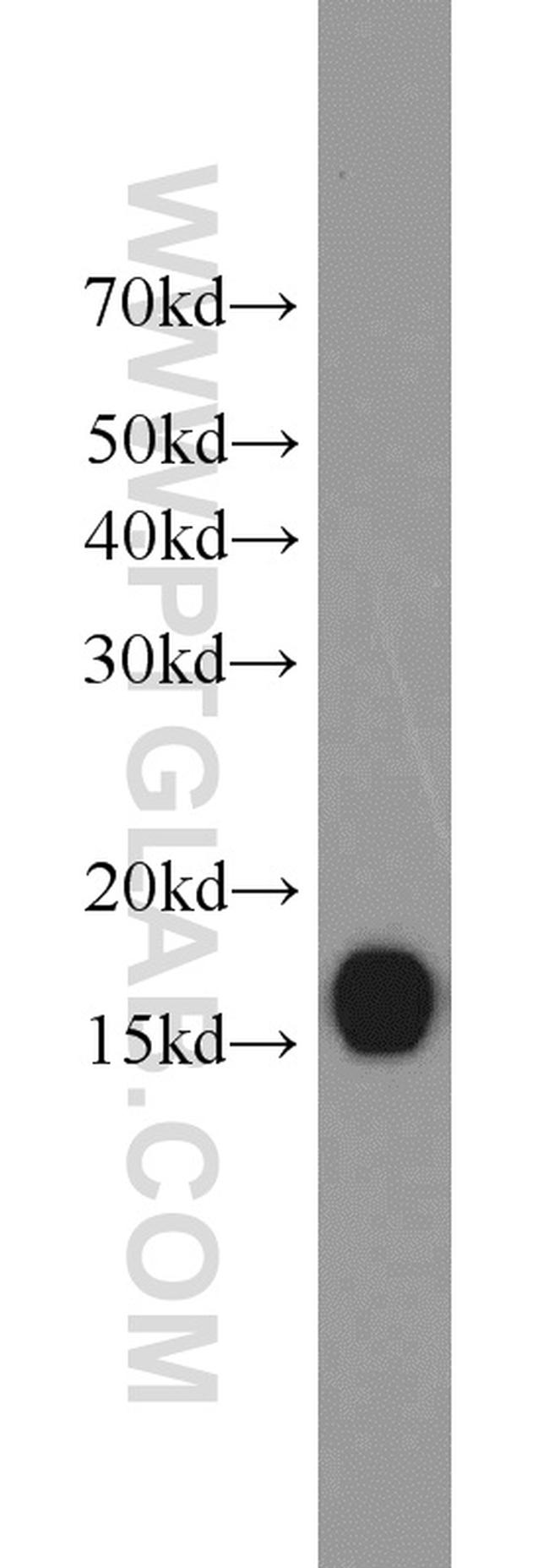 BLOC1S1 Antibody in Western Blot (WB)