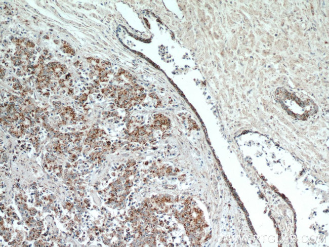 HIP1 Antibody in Immunohistochemistry (Paraffin) (IHC (P))