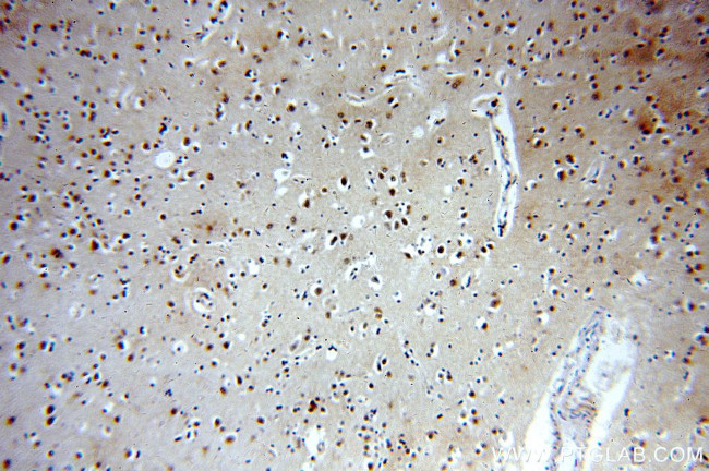 HIP1 Antibody in Immunohistochemistry (Paraffin) (IHC (P))