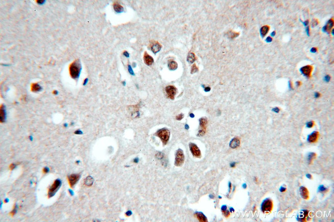 HIP1 Antibody in Immunohistochemistry (Paraffin) (IHC (P))