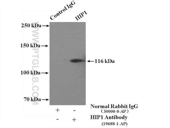 HIP1 Antibody in Immunoprecipitation (IP)