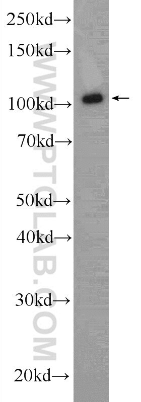 HIP1 Antibody in Western Blot (WB)