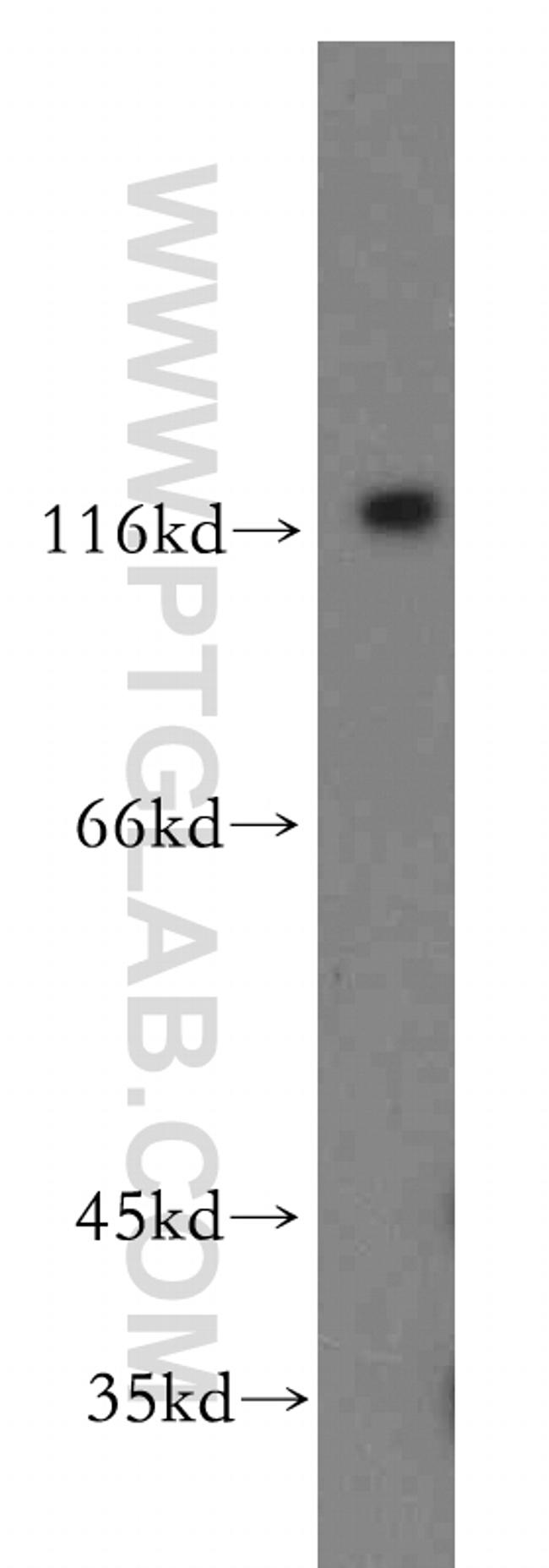 HIP1 Antibody in Western Blot (WB)