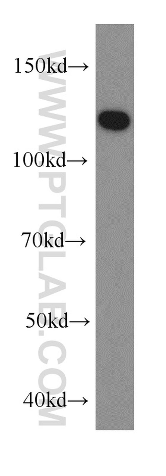 HIP1 Antibody in Western Blot (WB)