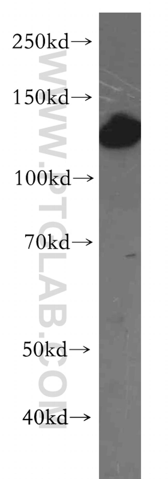 HIP1 Antibody in Western Blot (WB)