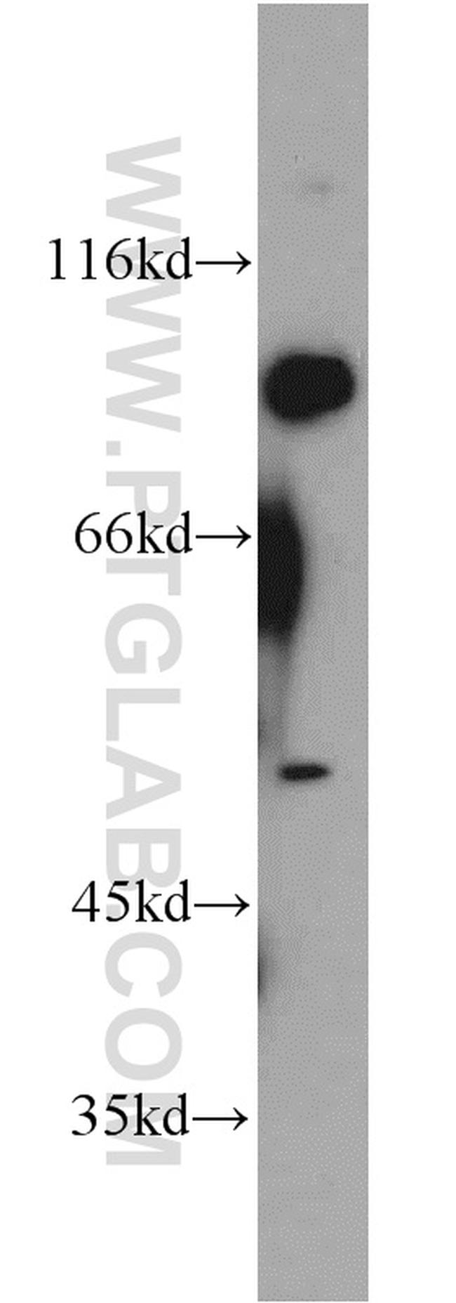 EIF2C1 Antibody in Western Blot (WB)