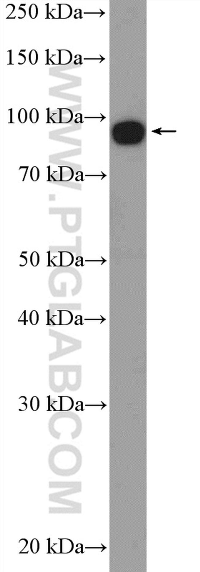 EIF2C3 Antibody in Western Blot (WB)