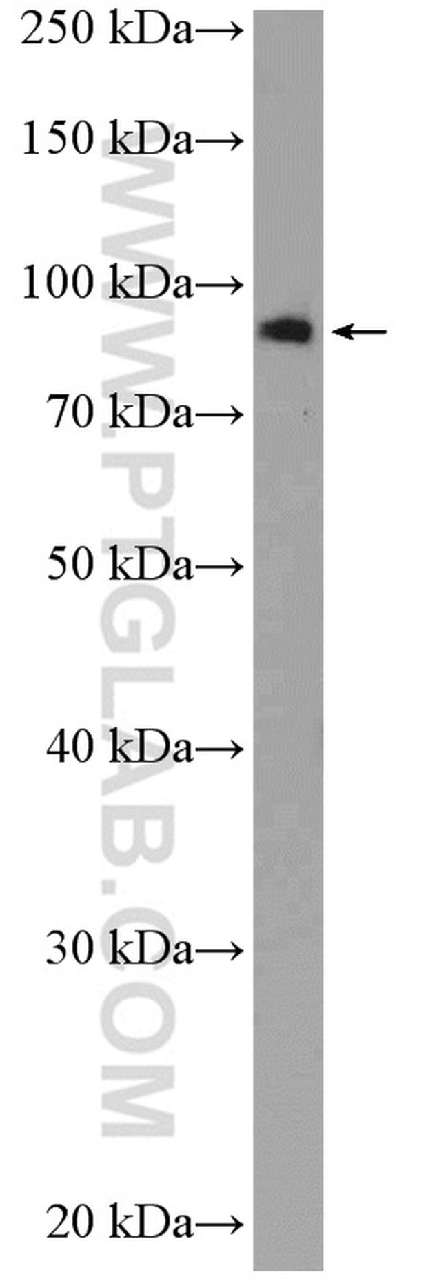 EIF2C3 Antibody in Western Blot (WB)