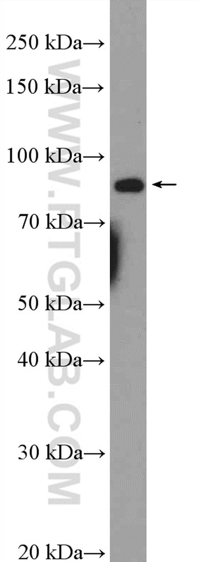 EIF2C3 Antibody in Western Blot (WB)