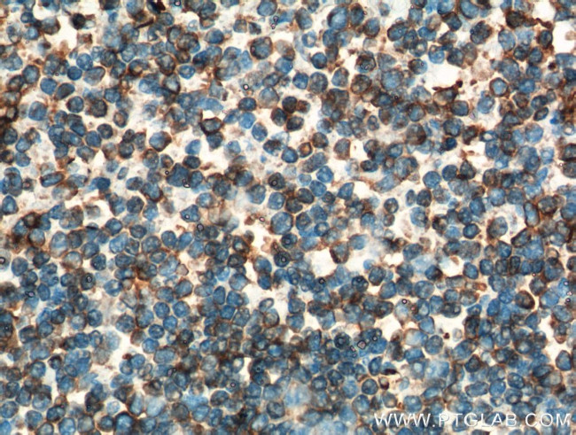 INPP5D Antibody in Immunohistochemistry (Paraffin) (IHC (P))