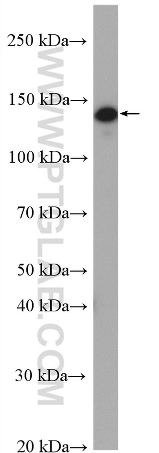 INPP5D Antibody in Western Blot (WB)