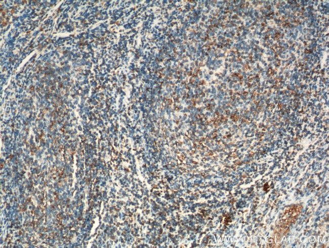 INPP5D Antibody in Immunohistochemistry (Paraffin) (IHC (P))