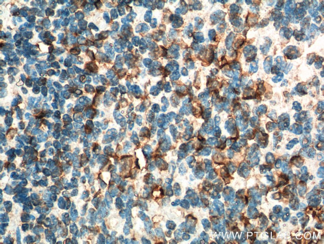 INPP5D Antibody in Immunohistochemistry (Paraffin) (IHC (P))