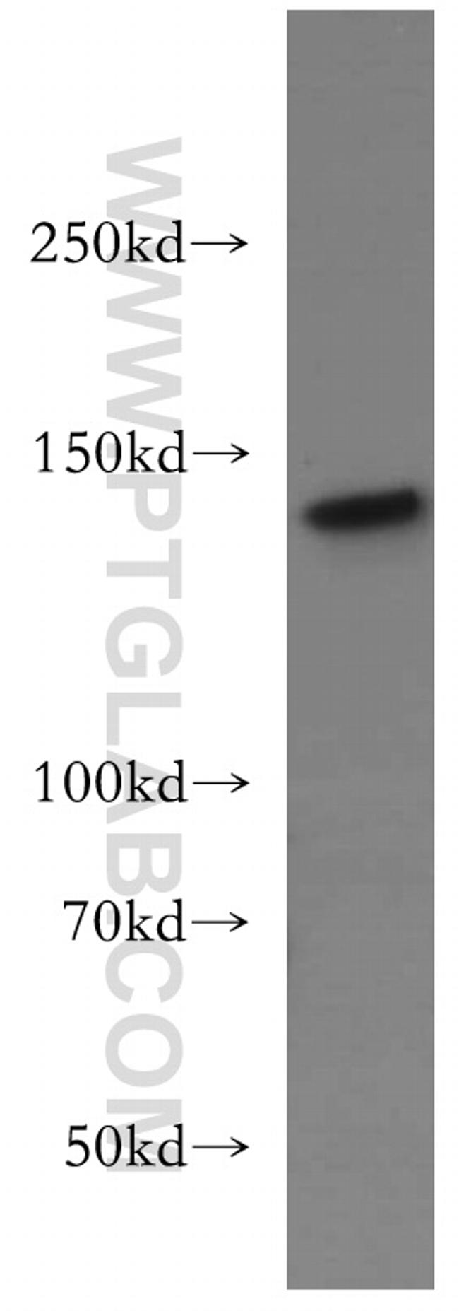 INPP5D Antibody in Western Blot (WB)