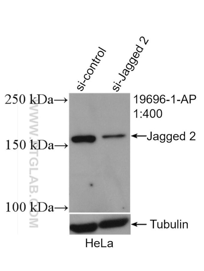 Jagged 2 Antibody in Western Blot (WB)