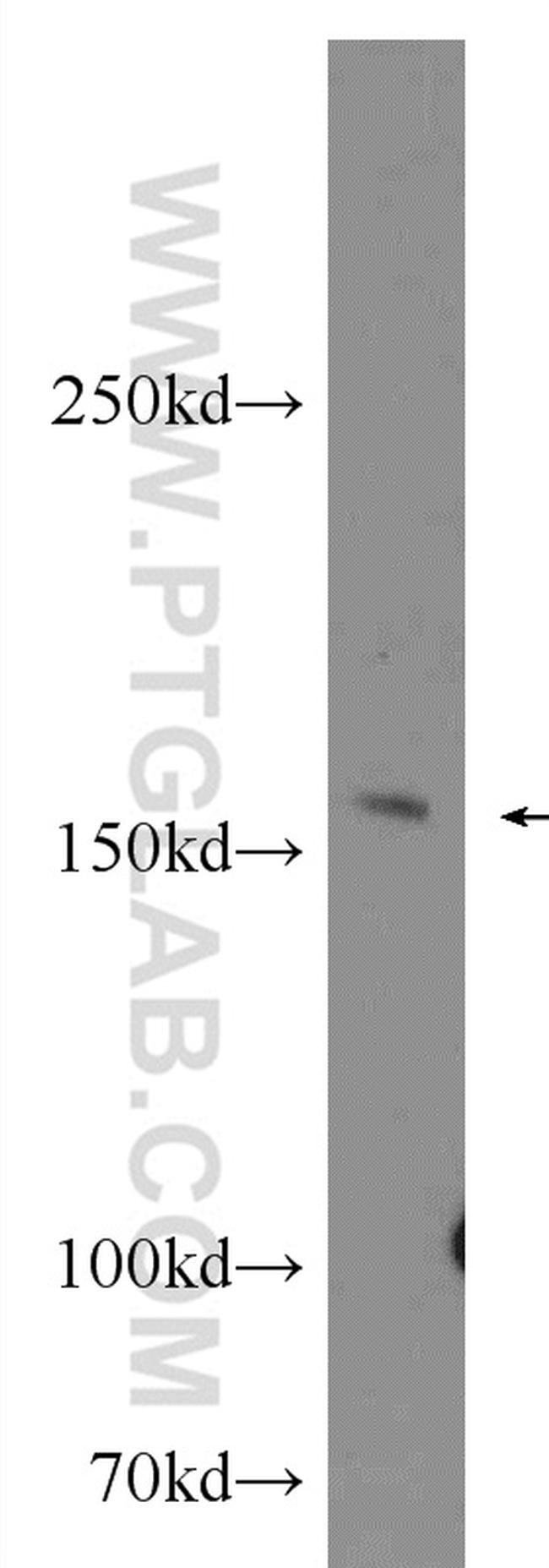 Jagged 2 Antibody in Western Blot (WB)